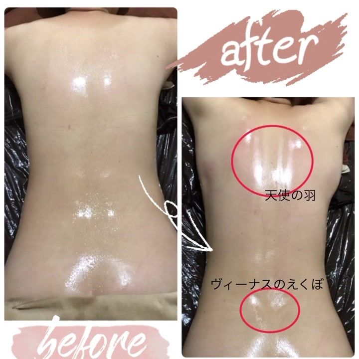予約殺到 雑誌やsnsで話題のイヤココ 耳ツボジュエリーのような貼るだけリフトアップが叶う 医療用テープを使用しており 銅線は24金でコーティングされているため 金アレが起きないという証明もされてます 貼るだけタイプです 耳ツボのようにツボに
