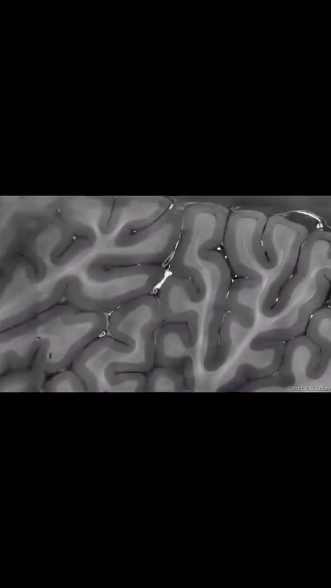 دخلت داخل دماغ بشري زي جوجل ماب.. اللي شفته مرعب علمياً! 😳🧠 تقنية HiP ...