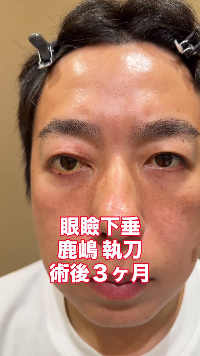 眼形成外科医 鹿嶋友敬 (@gankeisei) • Facebook