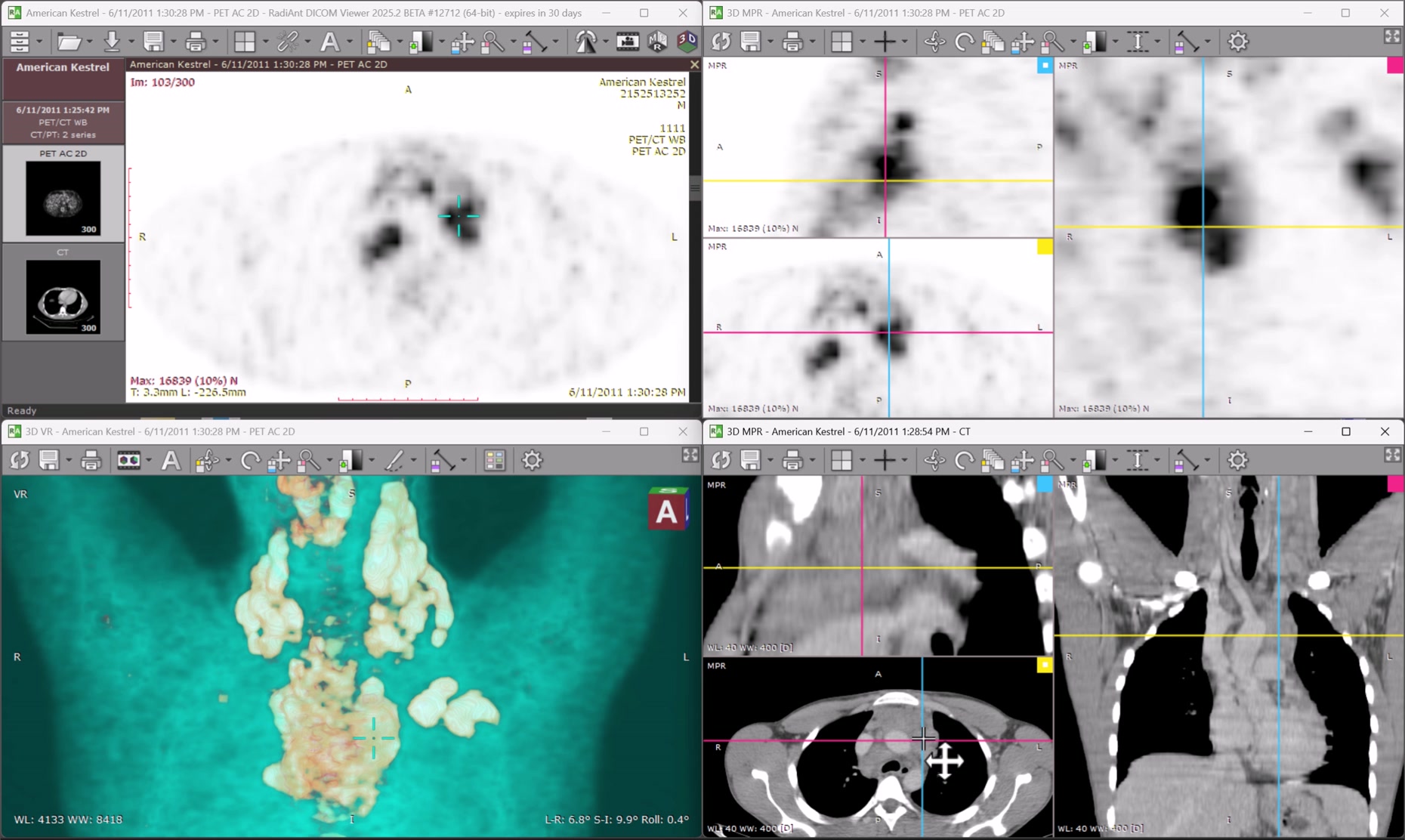 RadiAnt Dicom Viewer