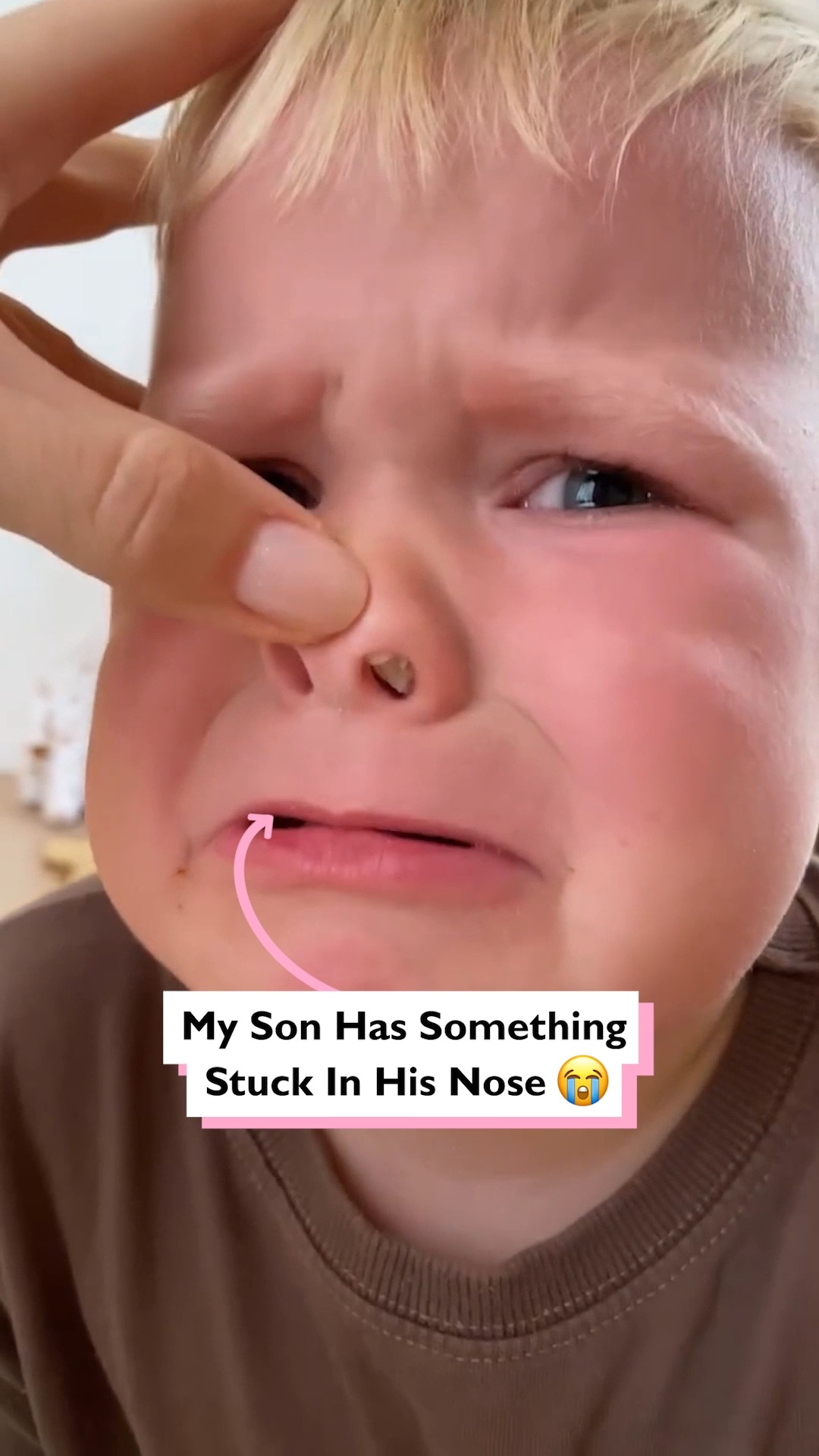 My son has something stuck up his nose 😭👃 #nose #child #stuck | Four ...