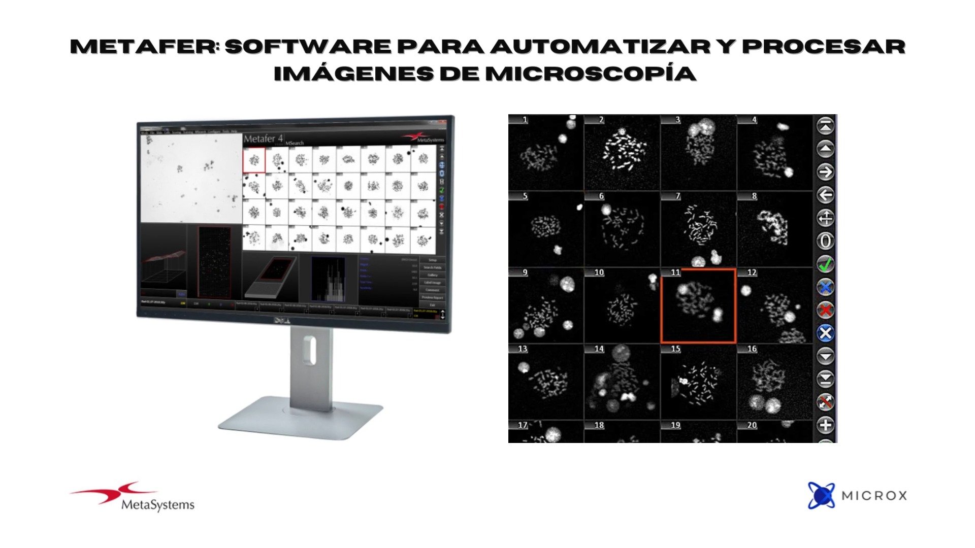Metafer: Software para automatizar y procesar imágenes de microscopía ...