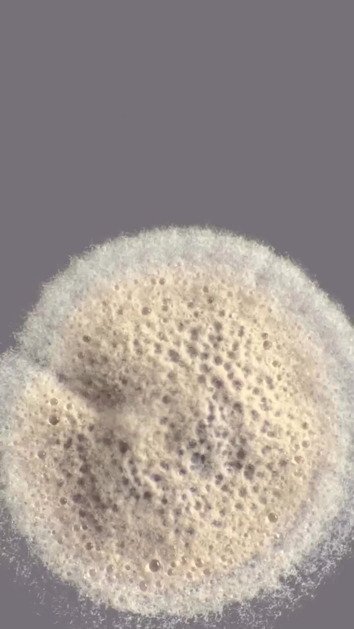 les types de colonies des bacteries Les types de colonies bactériennes ...