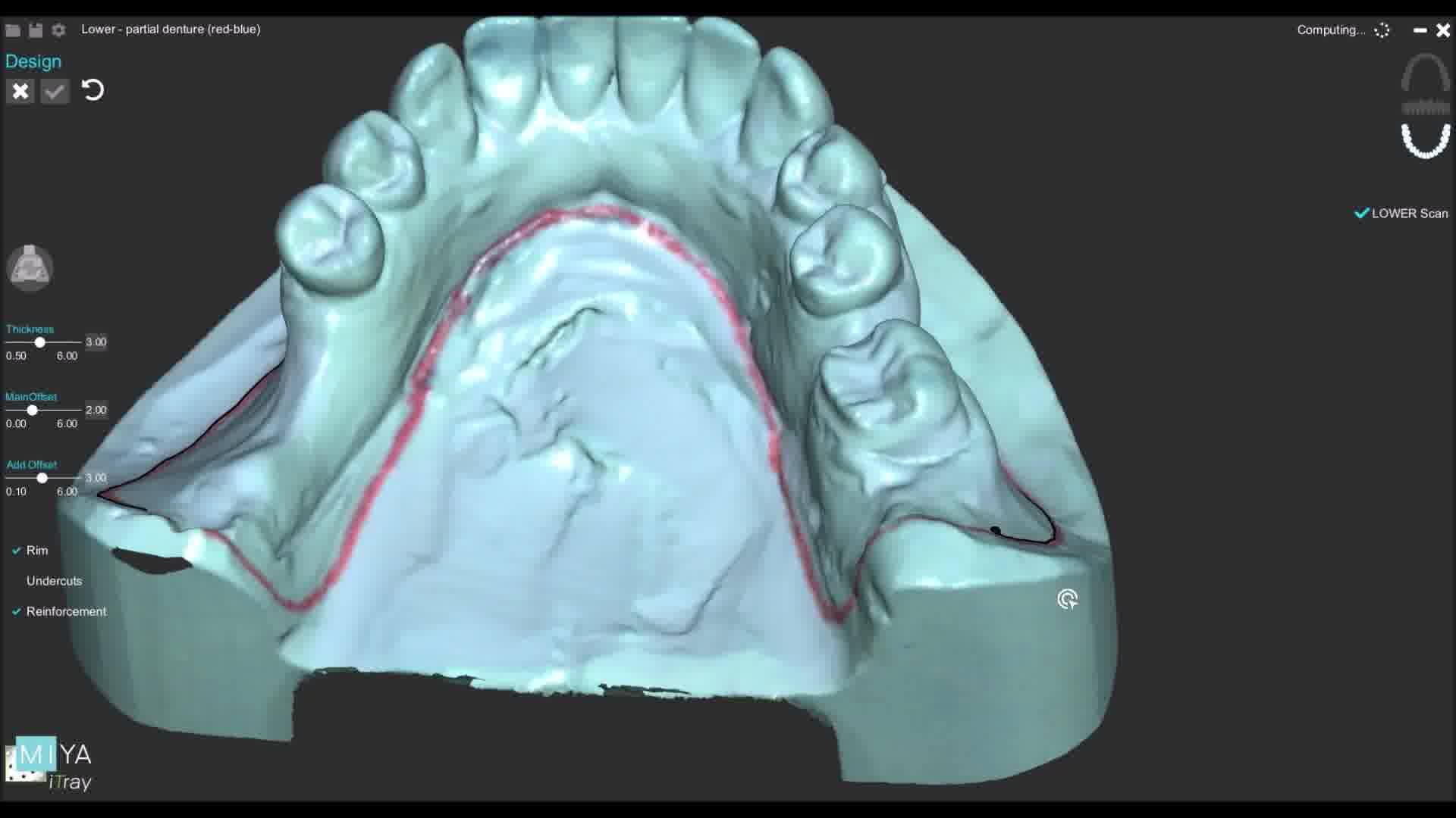 Keep watching ! MIYA iTray, a set of innovations designed for you. 3D ...
