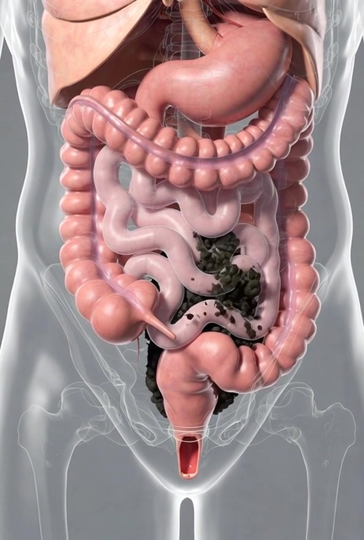 A healthy digestive system keeps your body active and clean from inside ...