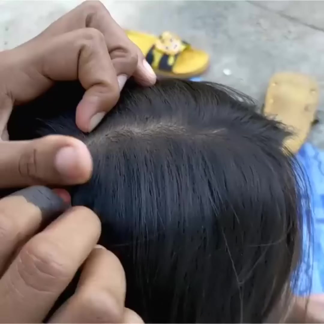 Getting out all lice from short hair | Rate Videos | Facebook