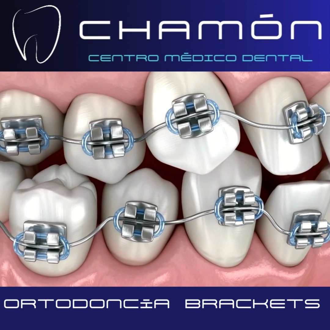 Chamon Centro Medico Dental | Madrid