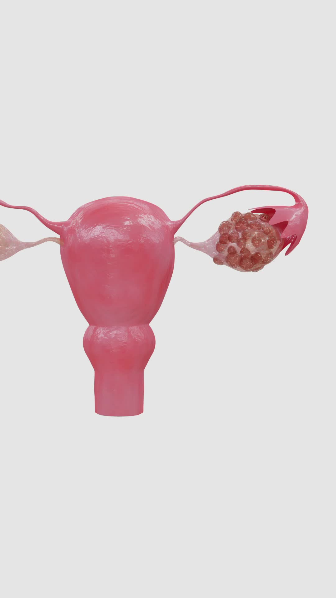 Effective ways to Manage PCOS , Part 2. #reels #health #science # ...