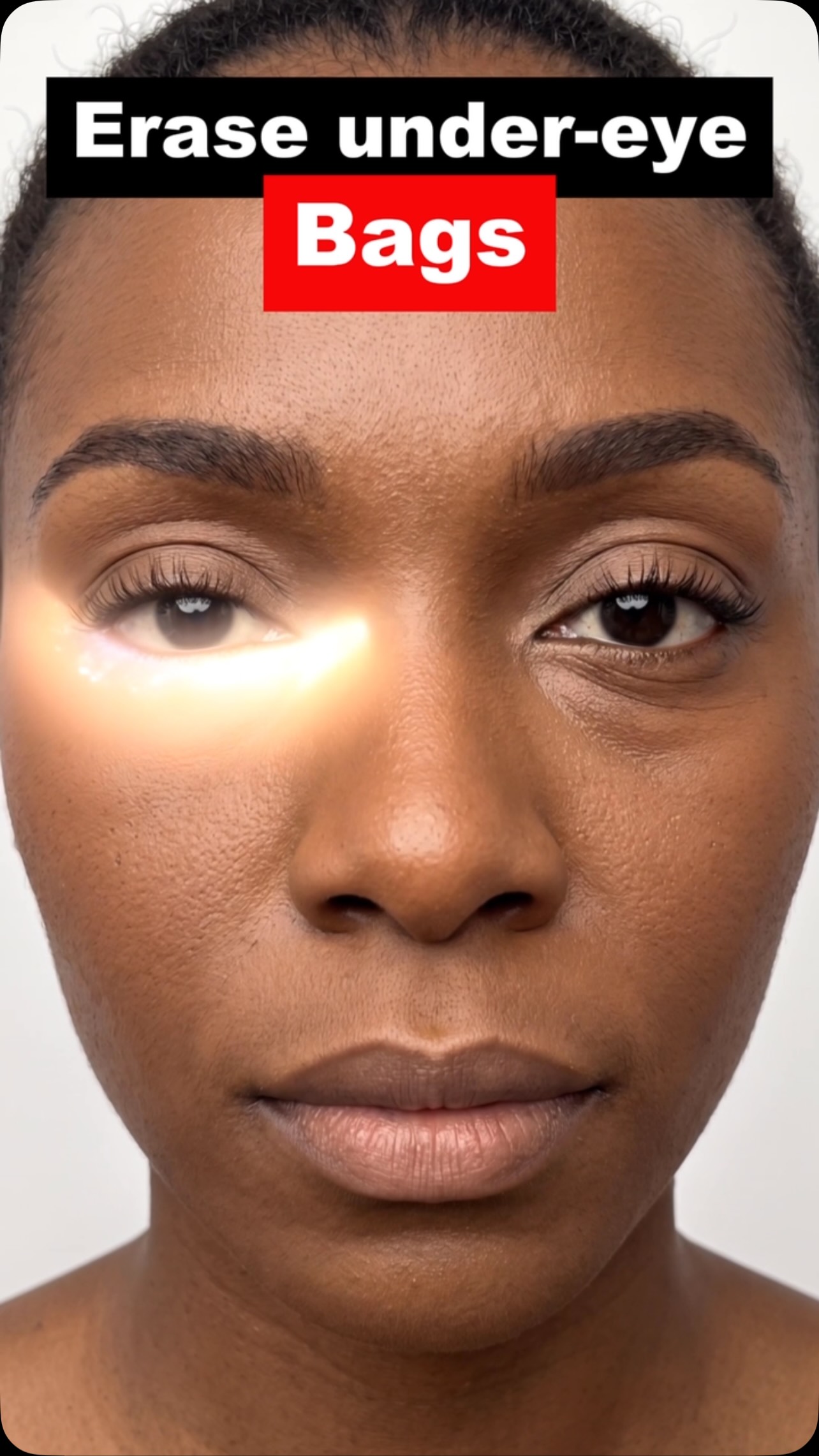Undereye puffiness is a problem for so many of us. In some cases, it's relatively mild, but in others it can best be described as 