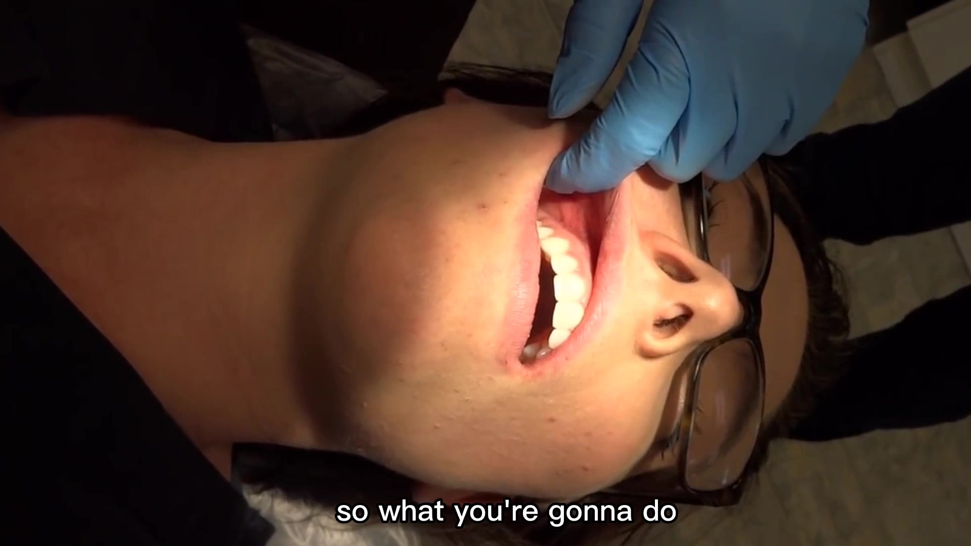 ASA injection technique 👌 Anterior Superior Alveolar injection ...