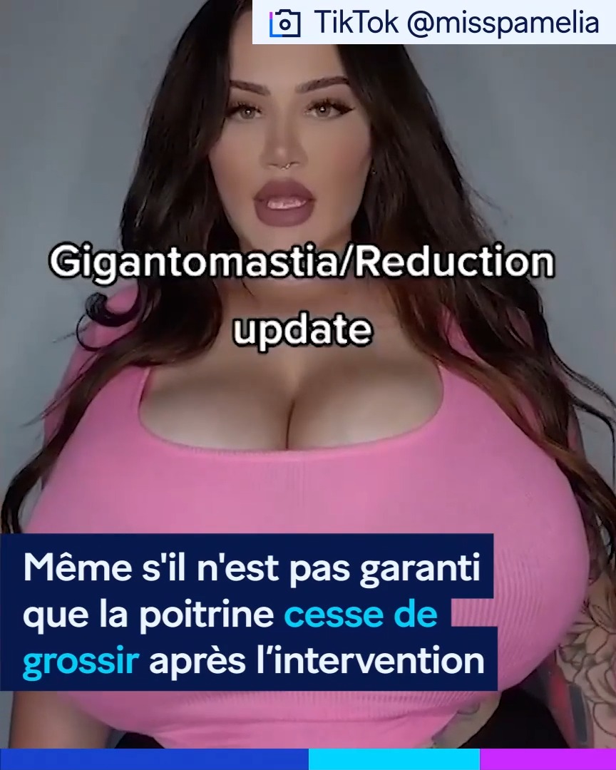 Mannequin sur Onlyfans, elle souffre de ses seins qui n’arrêtent pas de