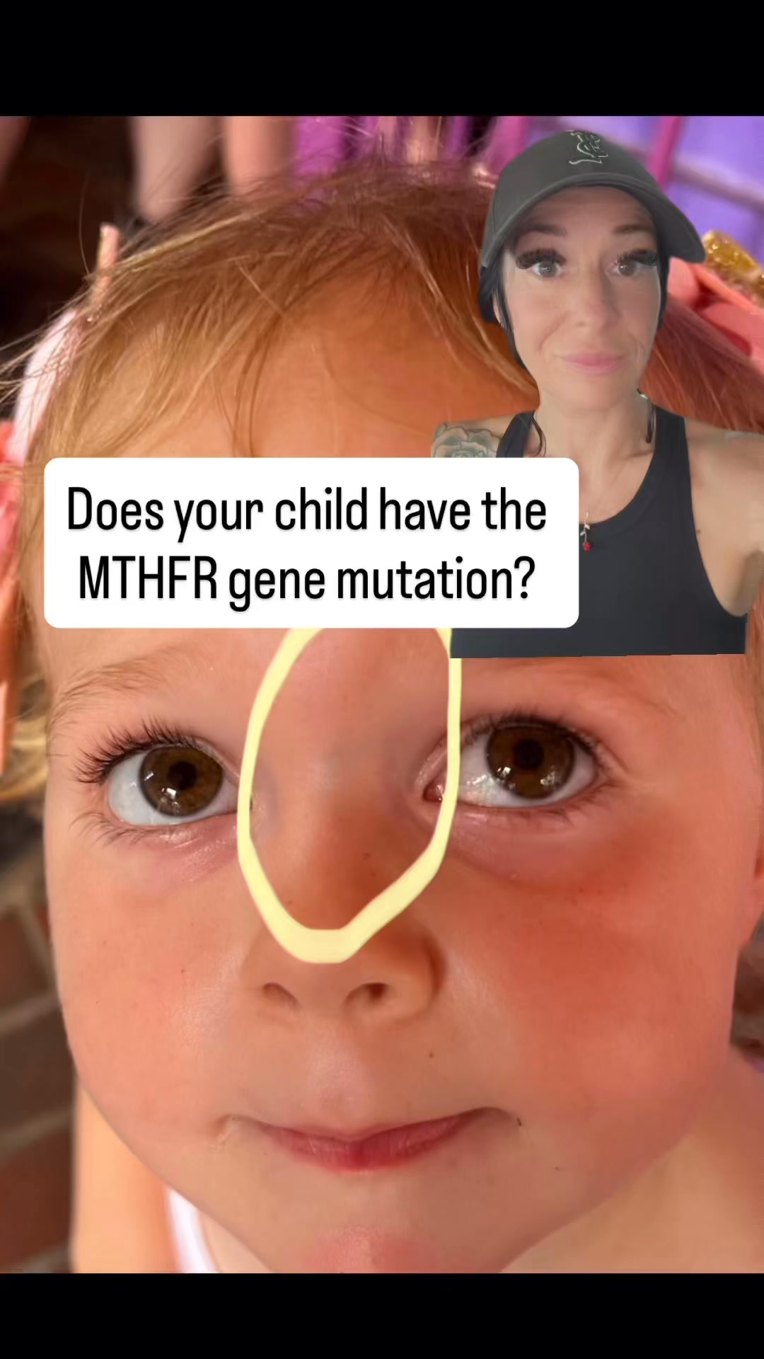 Supporting detox pathways for child with MTHFR mutation?