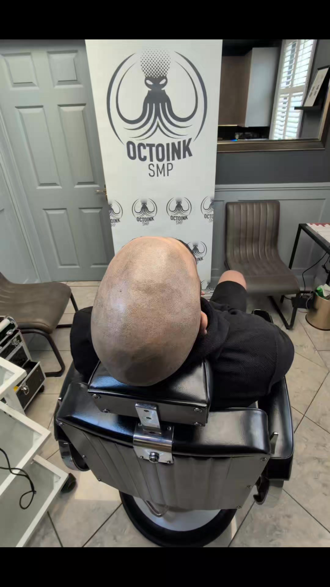 Octoink Scalp Micropigmentation