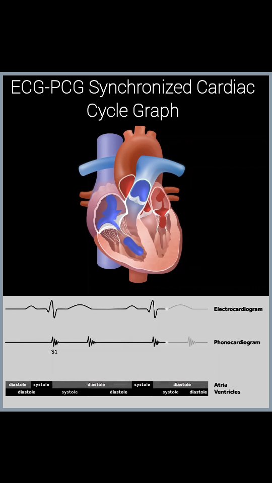 🎵 Hear the Rhythm: ECG-PCG + Real Heart Sounds in Sync! ️📉🔊 ECG ...