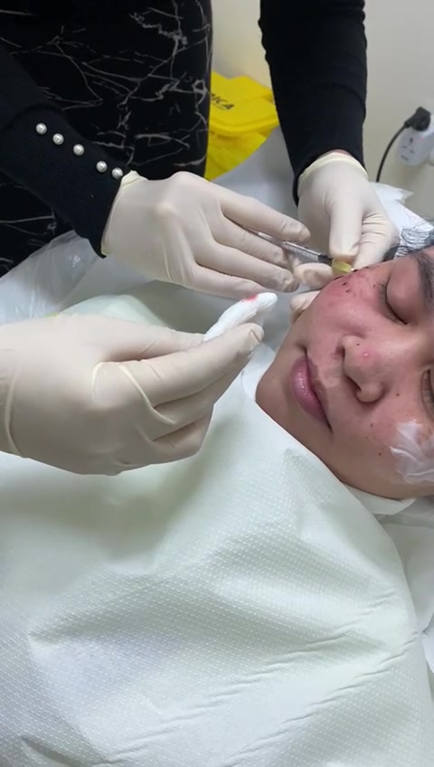 does glutathione remove hyperpigmentation Can Really Whiten Your Skin? 8010840001: Want Glutathione Injections but