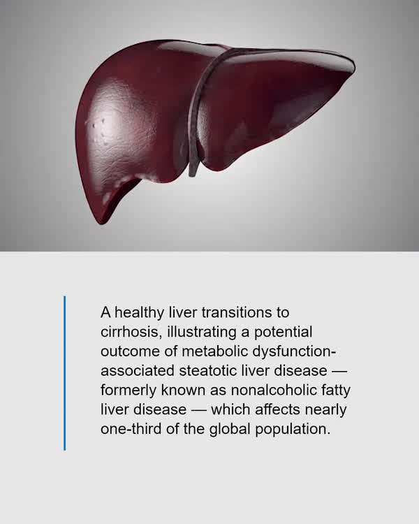 mayo clinic liver ast glutathione Researchers at Clinic's Center for Individualized Medicine have made a groundbreaking discovery: a rare genetic variant that can directly cause metabolic dysfunction-associated steatotic Clinical use of N-acetyl Size:Hospira Pfizer® – Bacteriostatic Water | Case of 25 × 30 mL Vials gel-bf