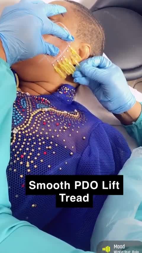 A PDO thread lift is a non-surgical facelift where facial skin is ...