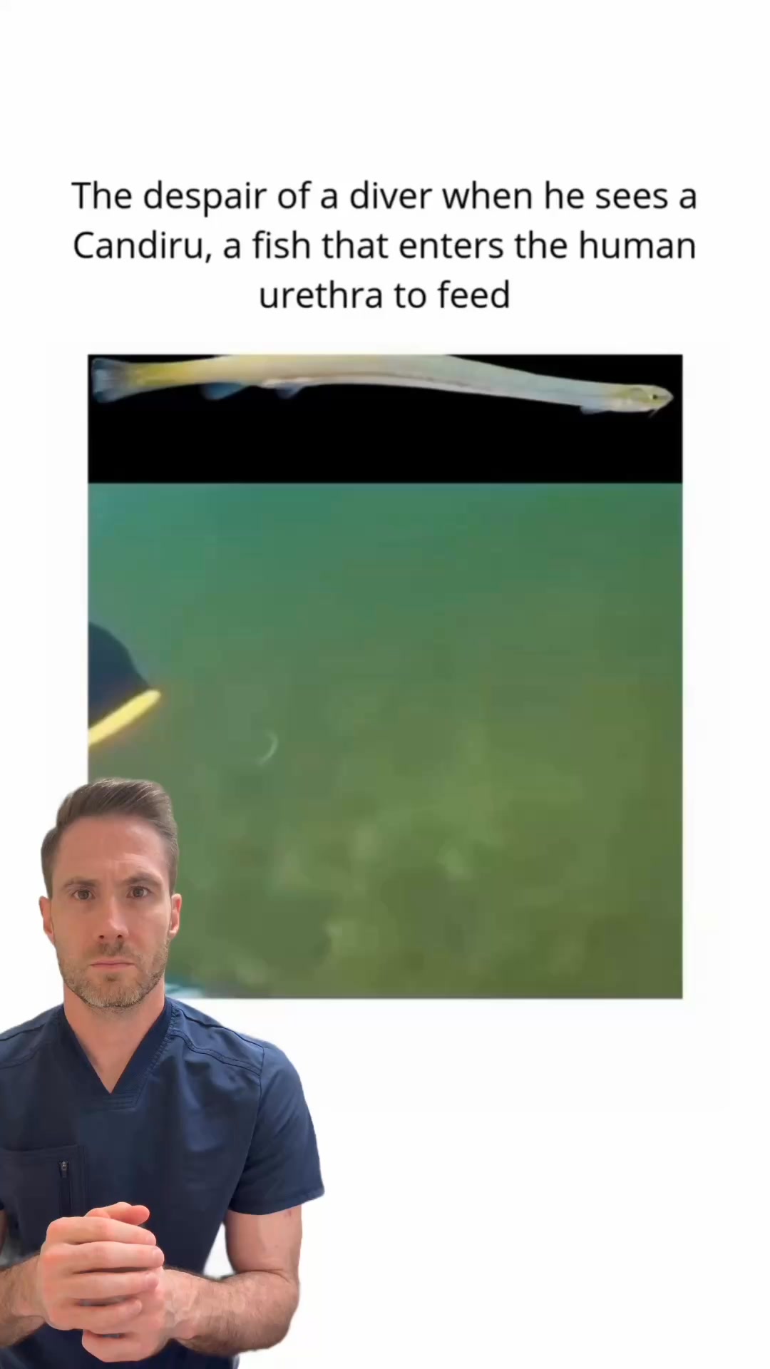 Meet the candiru fish: the tiny Amazonian terror with a huge reputation for invading places it doesn't belong . While its infamous urethra story might be more myth than reality, this little guy still 