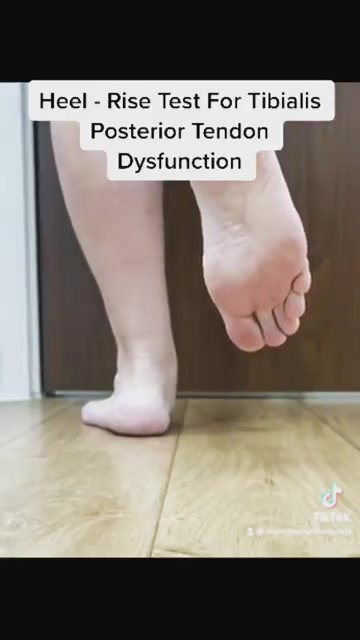 The heel rise test is used to assess static weight bearing muscle ...