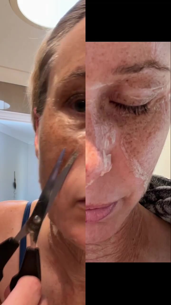 Time for a little snip 😂 Yes it’s my turn again & my skin is ...