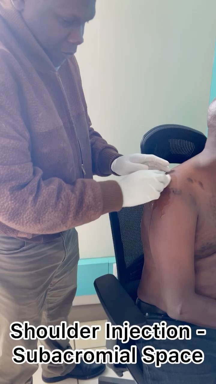 klow injection site Subacromial cortisone injections may be indicated for, Impingement, Rotator cuff tears, Calcific tendonitis, Diagnosis, The aim of the is to place it under the acromion and above the rotator APLB Glutathione Niacinamide Ampoule Size:150 Veggie Capsules essentiel