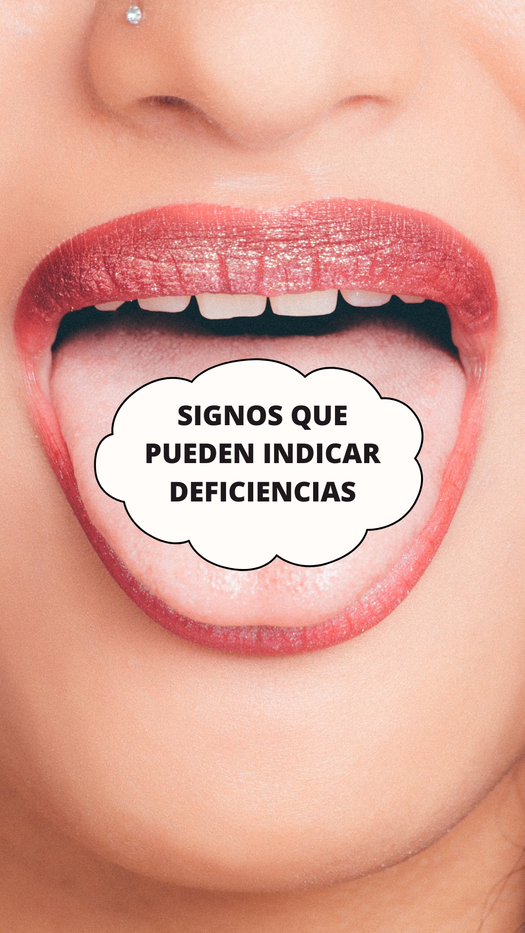 Estos síntomas pueden indicar deficiencias nutricionales. Es importante ...