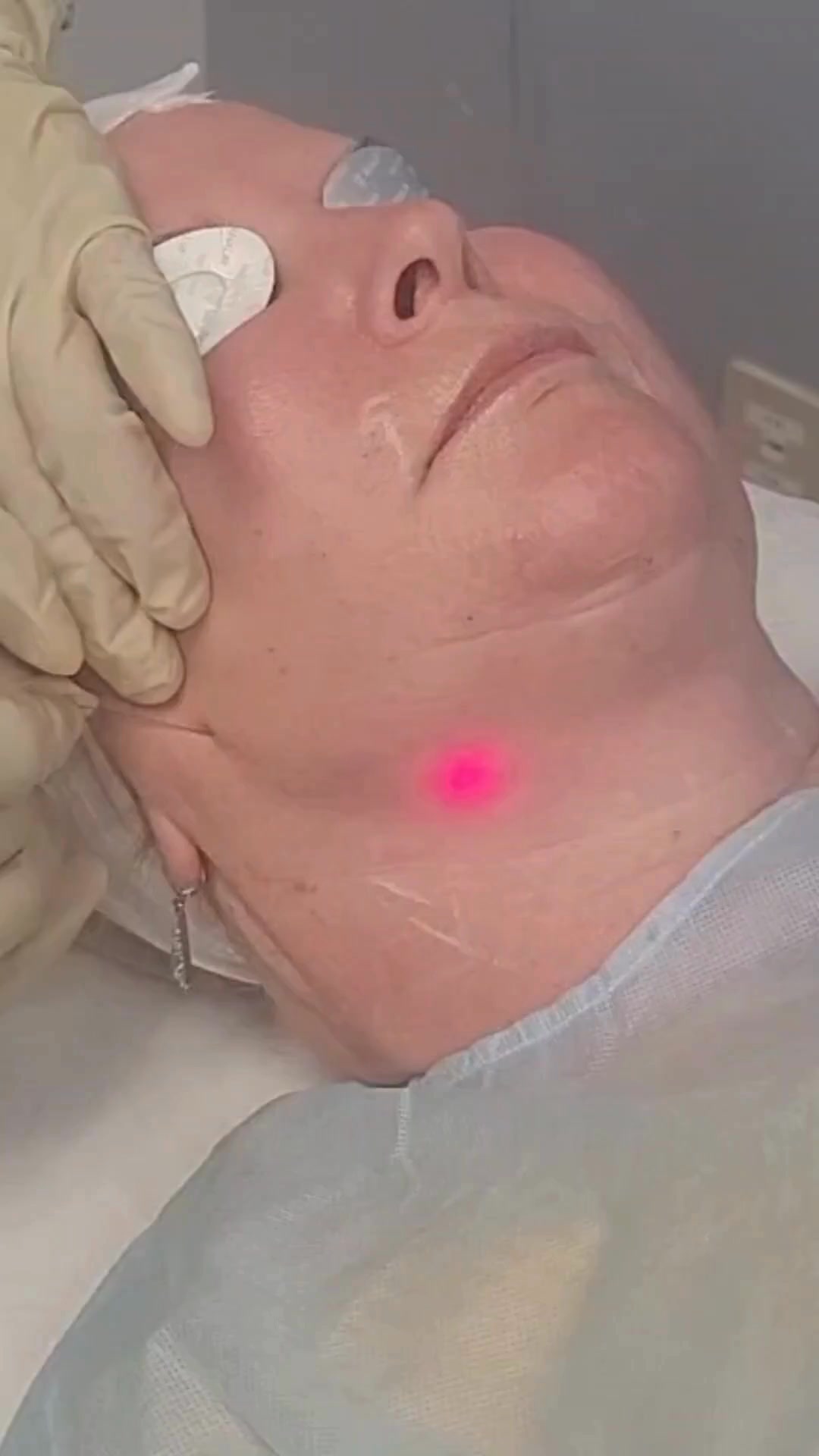 Target excessive fat deposits and skin laxity in a single, comfortable Endolift session! 💆‍♀️, What makes Endolift a TOP beauty/antiaging treatment? It addresses the top beauty and antiaging concerns. 