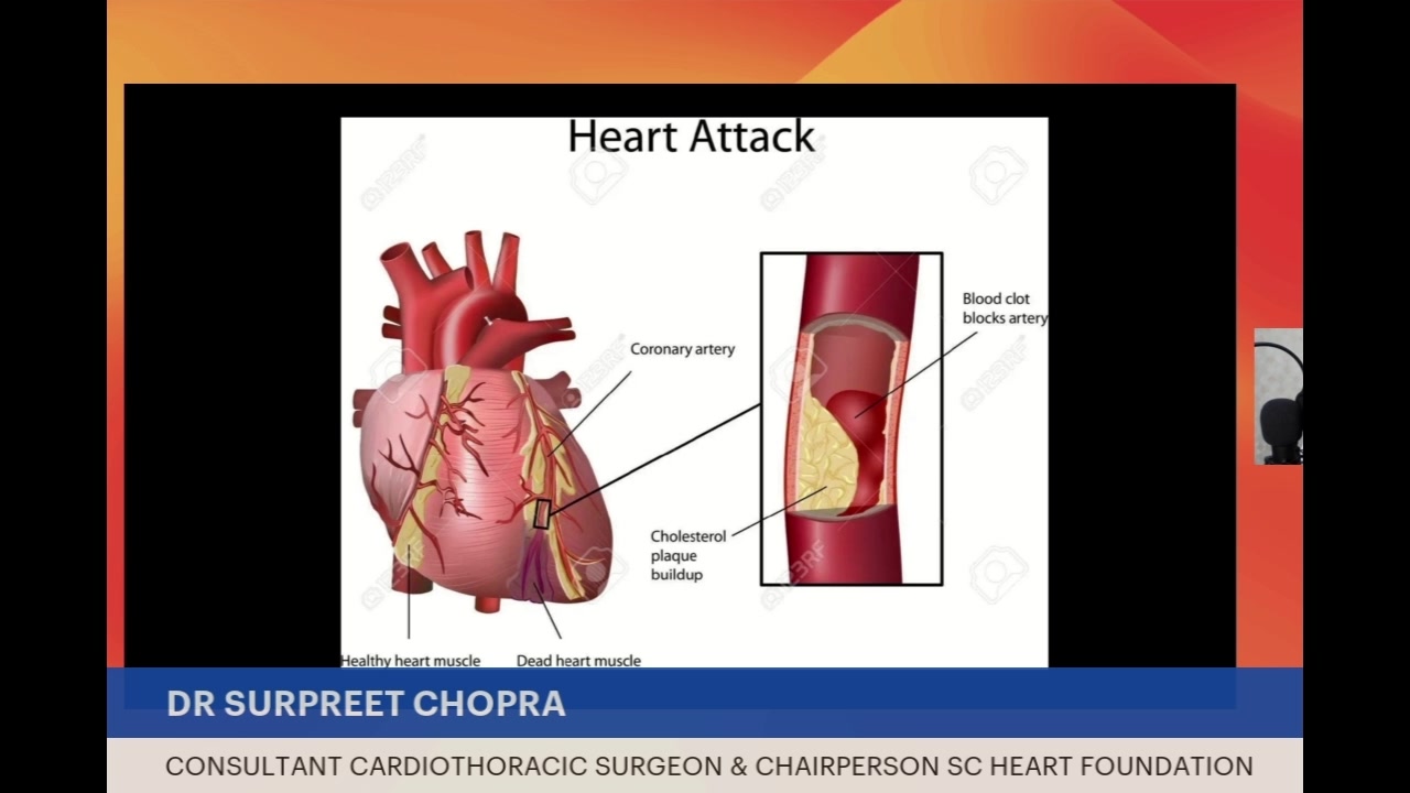 glutathione for heart angina KEY Difference between and attack is that angina is the result of narrowed (rather than blocked) coronary arteries. #CCU_CARD regenmed direct peptides bpc-157 pores and texture Size:1000ml
