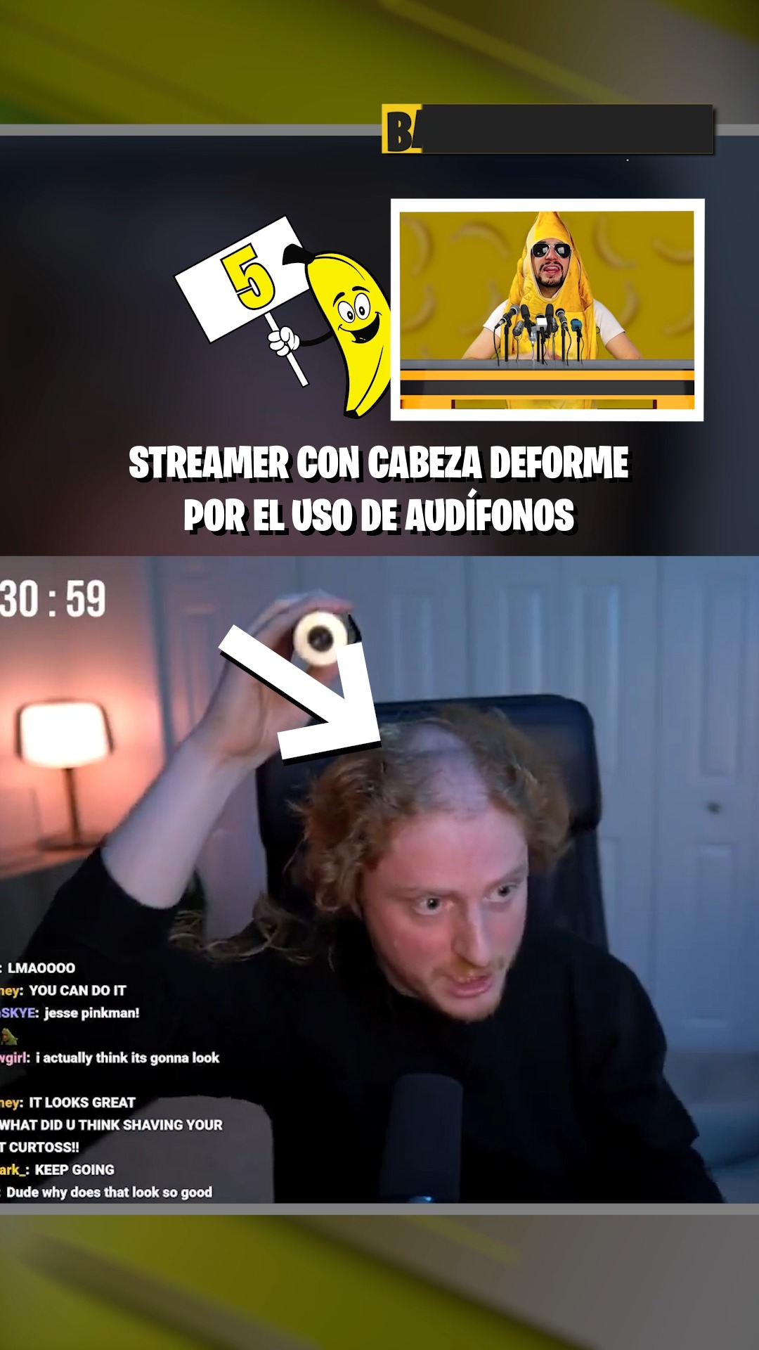 ¡Bananews! 🍌🎮😎 La cabeza de un streamer se había deformado por el uso ...
