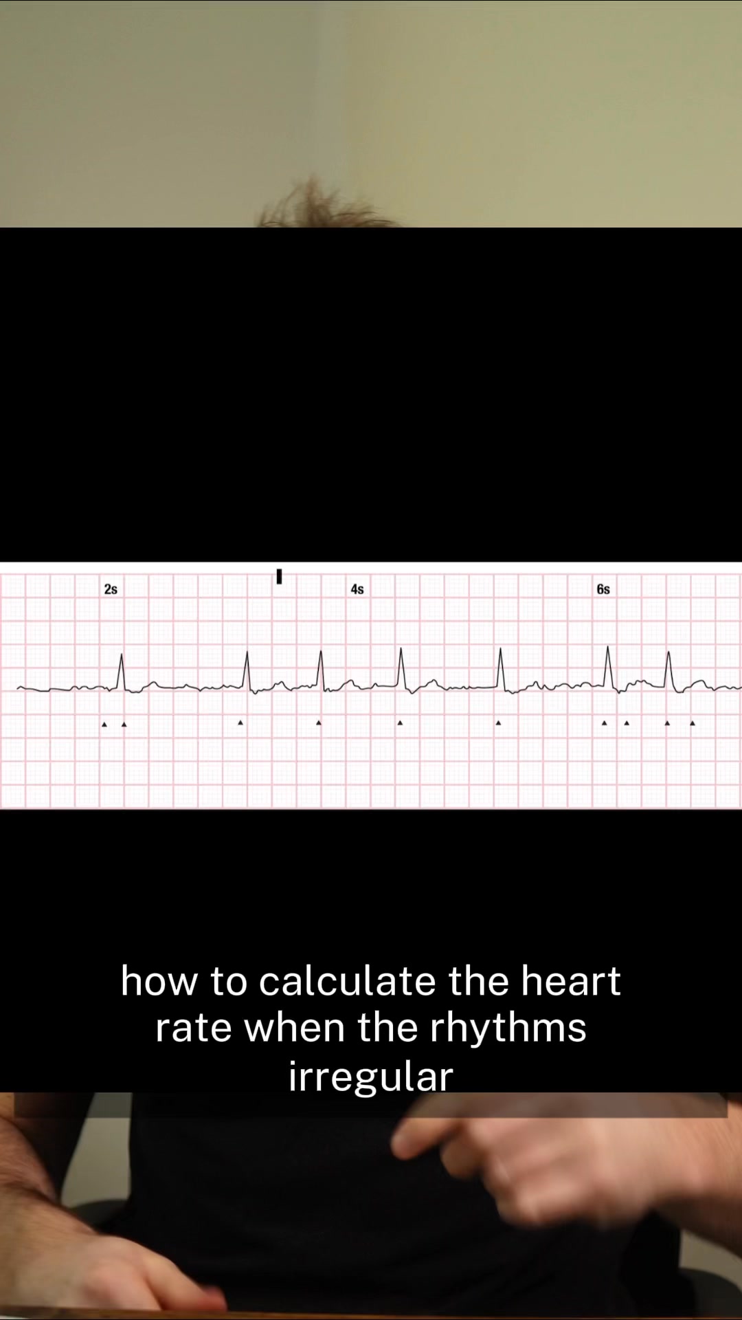 How to calculate the heart rate when the rhythms irregular 🚑👉 If you’re ...