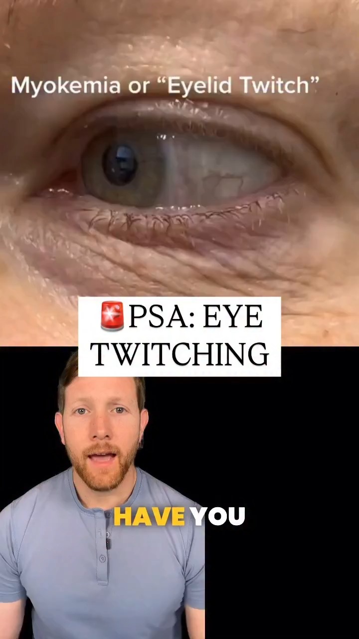 Random eye twitches happen on the upper or lower lid and are called myokymia. Triggers range from stress and smoking to wind, bright light, too much caffeine, and lack of sleep. https://wb.md/3N2TcDi