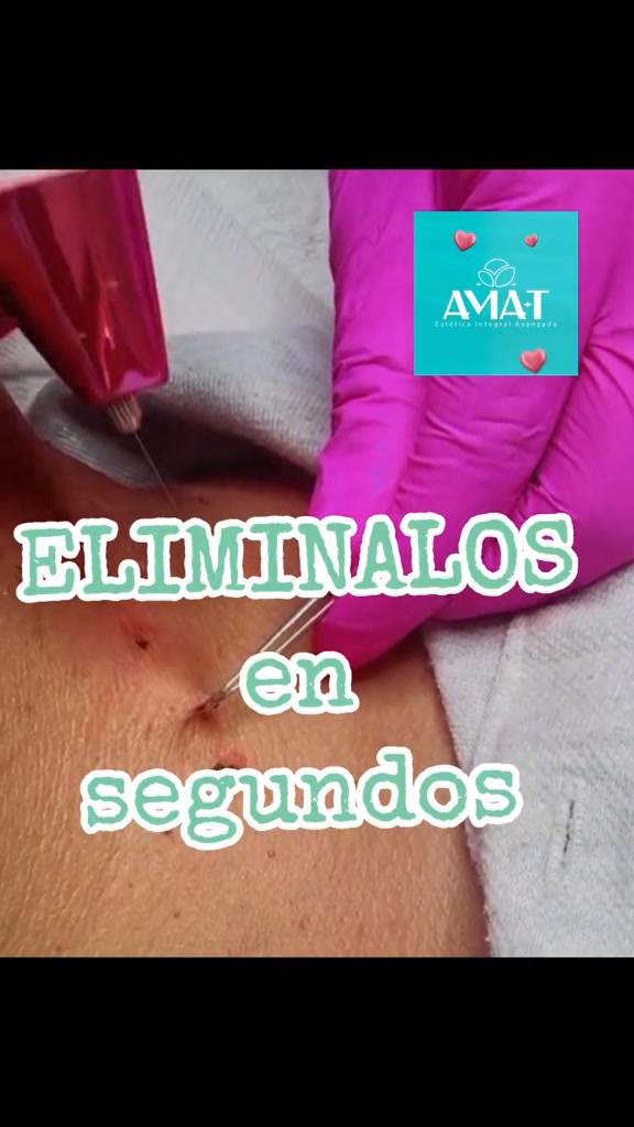 AMA-T | Arequipa