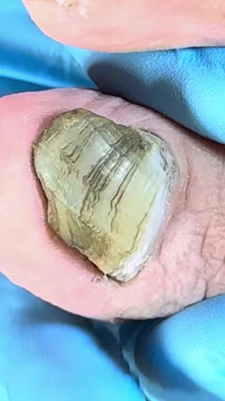 The truth pulled out of this nail is shocking H2PD Beautiful moments of ...