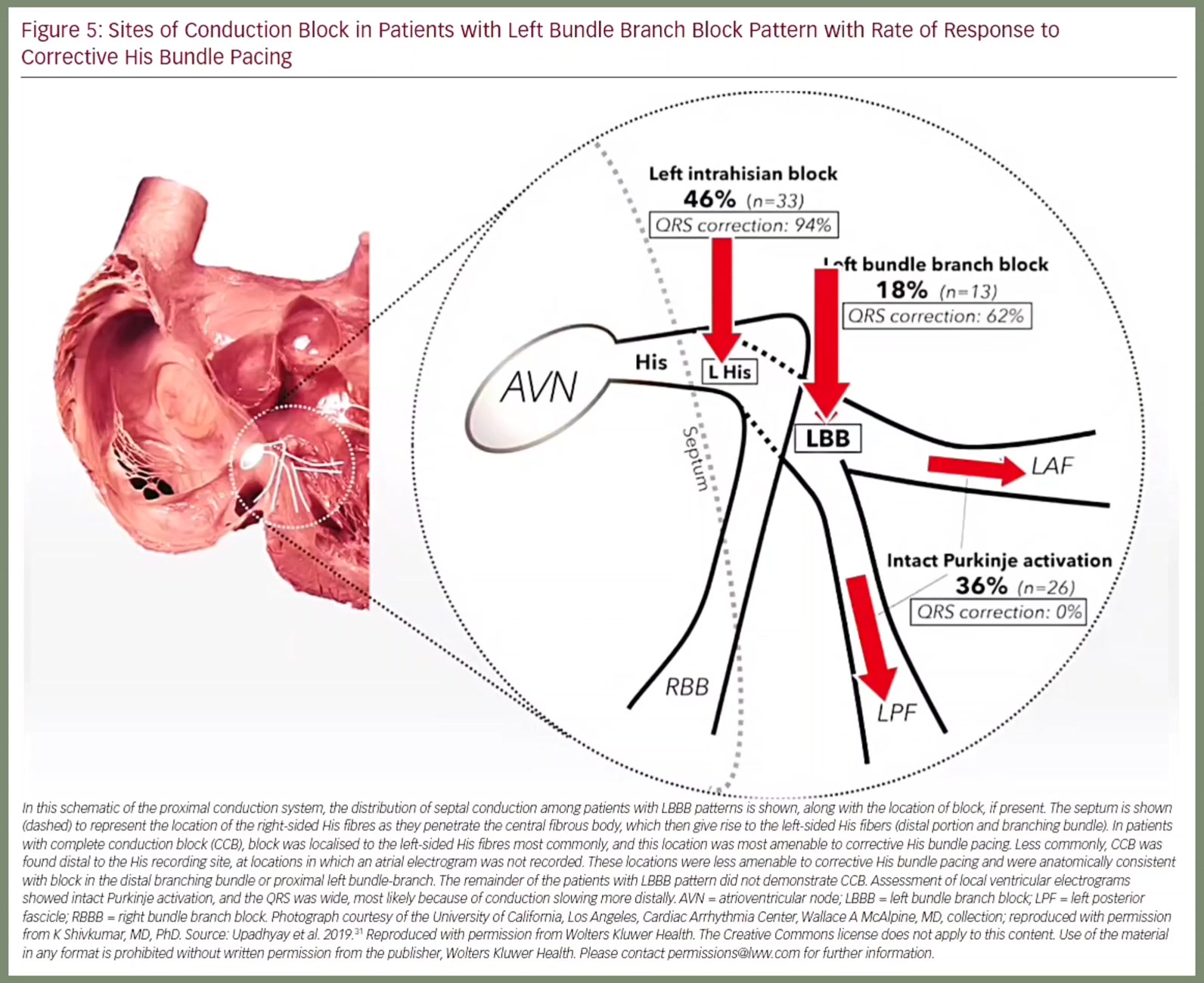 📚 Arrhythmia & Electrophysiology Review 2020;9(1):28–33 ...