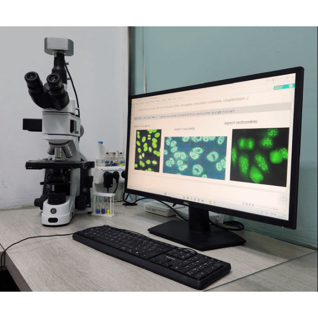 L'immunofluorescence indirecte (IFI) sur les cellules HEp-2 reste la ...