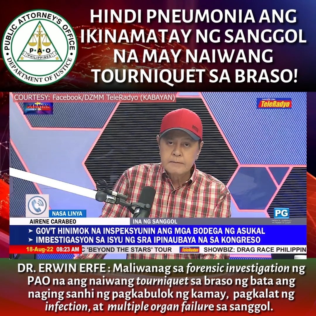 HINDI PNEUMONIA ANG IKINAMATAY NG SANGGOL NA MAY NAIWANG TOURNIQUET SA ...