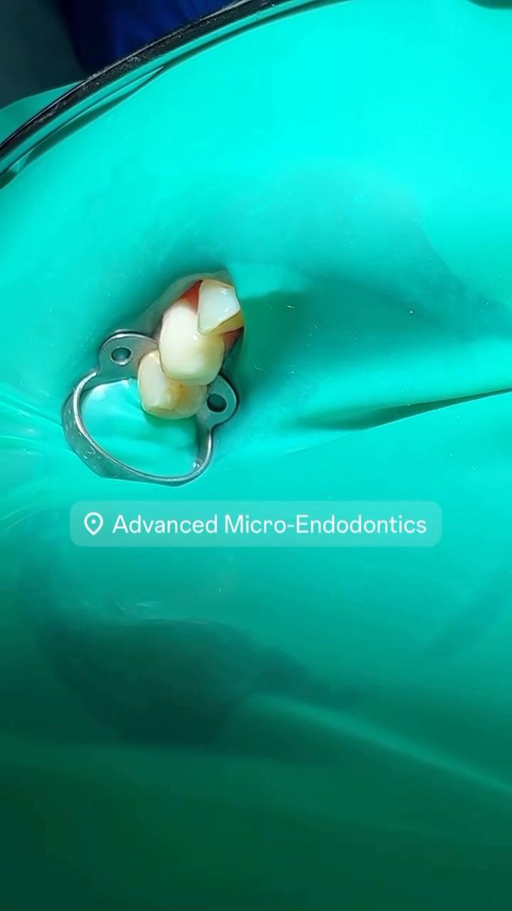 #dentistry #dentalschool #dentists #rootcanaltherapy #IVSedation ...