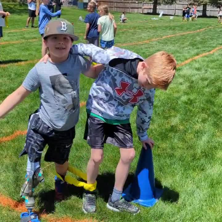 Knox's Rotationplasty... - Knox's Rotationplasty Journey