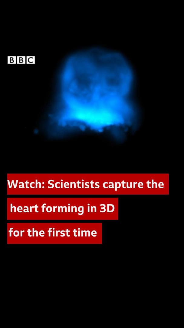 Researchers have, for the first time, identified the origin of cardiac ...