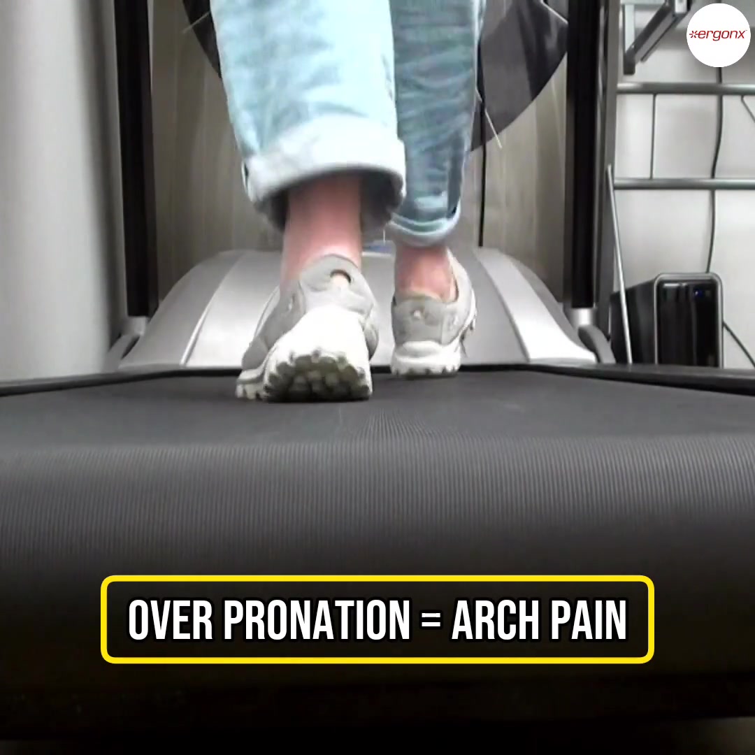 Overpronation happens when your foot rolls inward too much while ...
