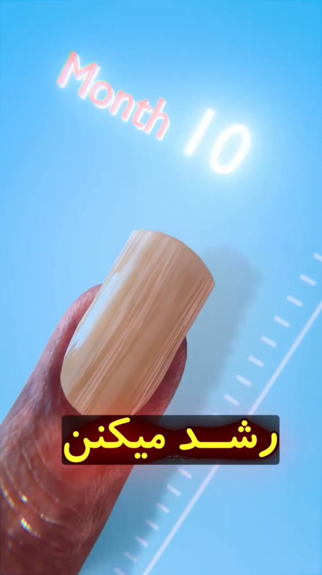 #نا_خن_کوتاه #مراقبت_ناخن #سلامت_ناخن #زیبایی_ناخن #پیشگیری_ناخن # ...