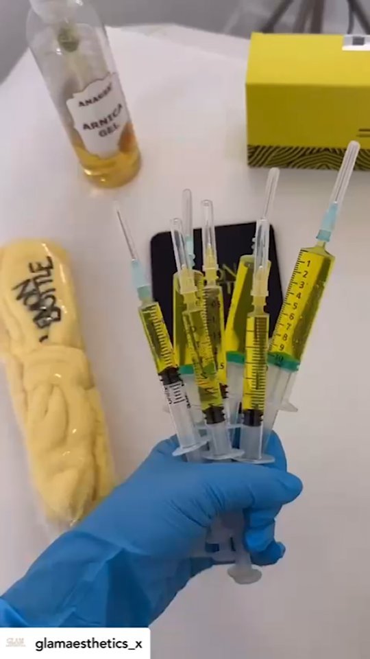lemon bottle fat dissolving needles LEMONBOTTLE training with one of our OFFICIAL LEMONBOTTLE TRAINING ACADEMY @glamaesthetics_x 💛💛💛, Learn the unique method of LEMONBOTTLE from our official academies if you want to مشروب ديتوكس Killer Klowns from Outer size:7.5kg