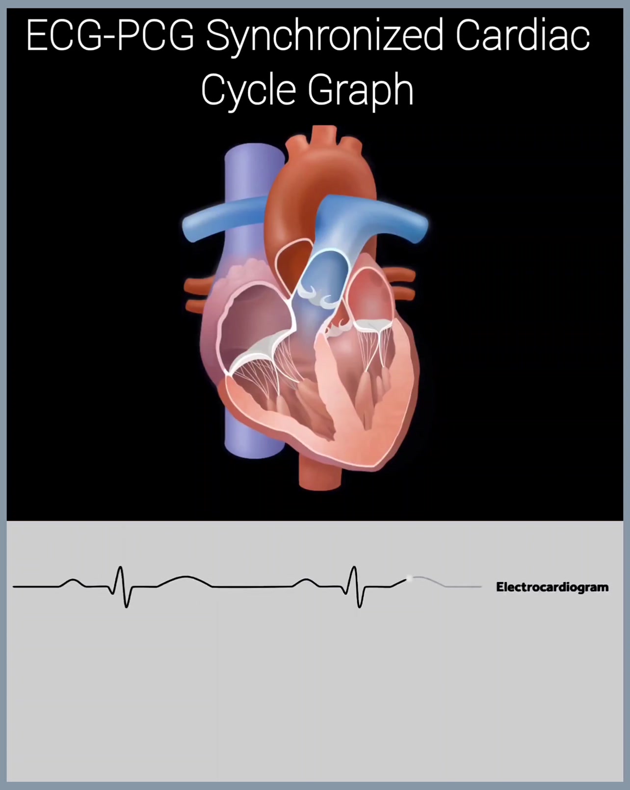🎵 Syncing the Beat: ECG-PCG Cardiac Cycle Unveiled! ️📈🔊 ECG: Tracks the ...