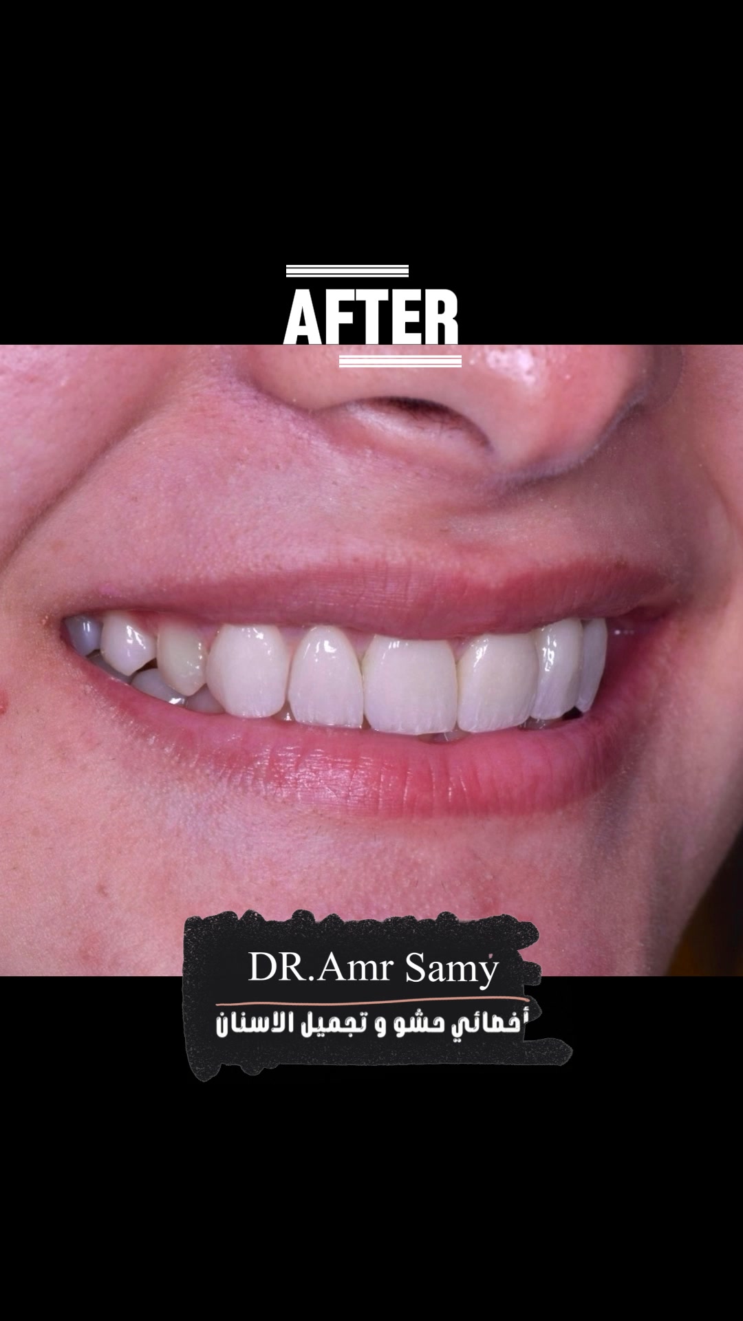 Bleachy Dental Clinics | Mansoura