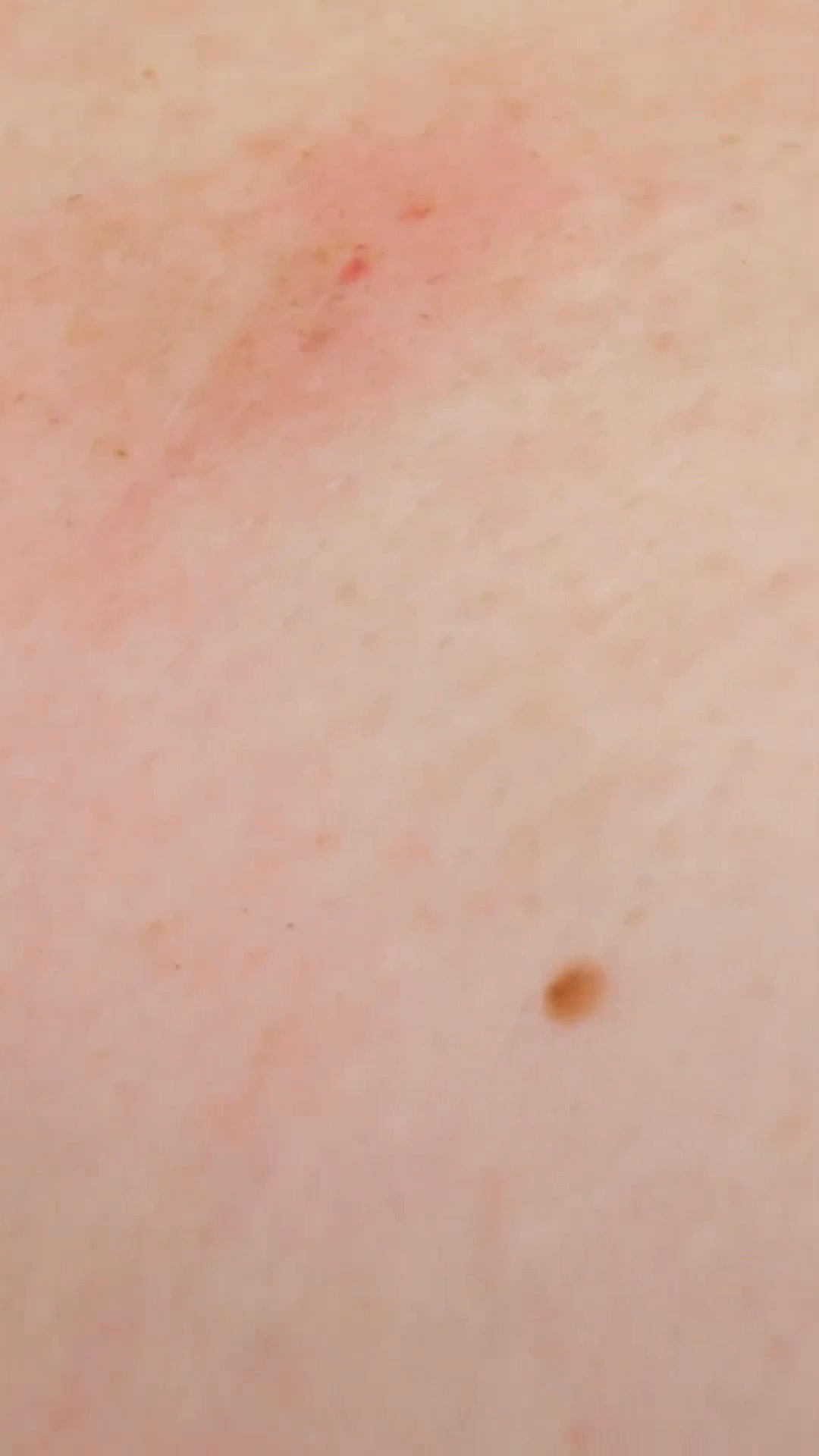 Mark got stung by the velvet ant (a.k.a. cow killer)! 🐜 #velvetant # ...