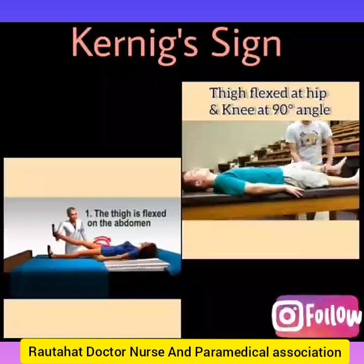 Kernigs Sign Meningitis Tests | Brudzinski's & Kernig's Signs
