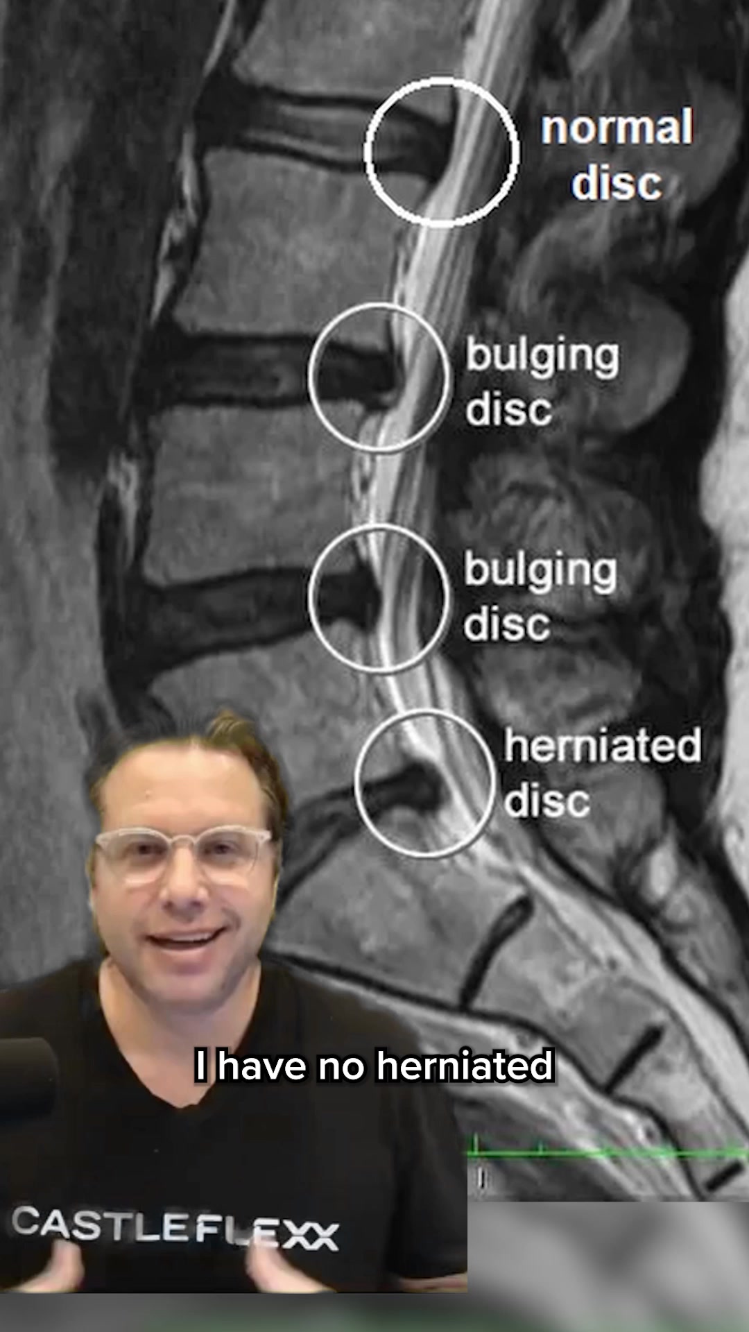 Struggling with back pain, plantar fasciitis, or tight muscles ...