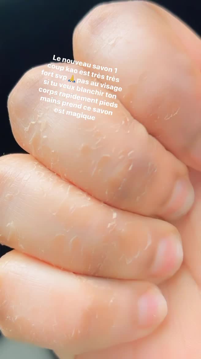 Savon Blanchissant Kao 1 Coup - 250g, Parfum Agrumes, à La Papaye Et Vitamine E, 100% Naturel