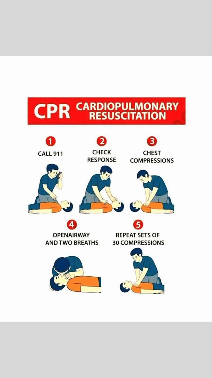 CPR (Cardiopulmonary Resuscitation) CPR is an emergency lifesaving ...