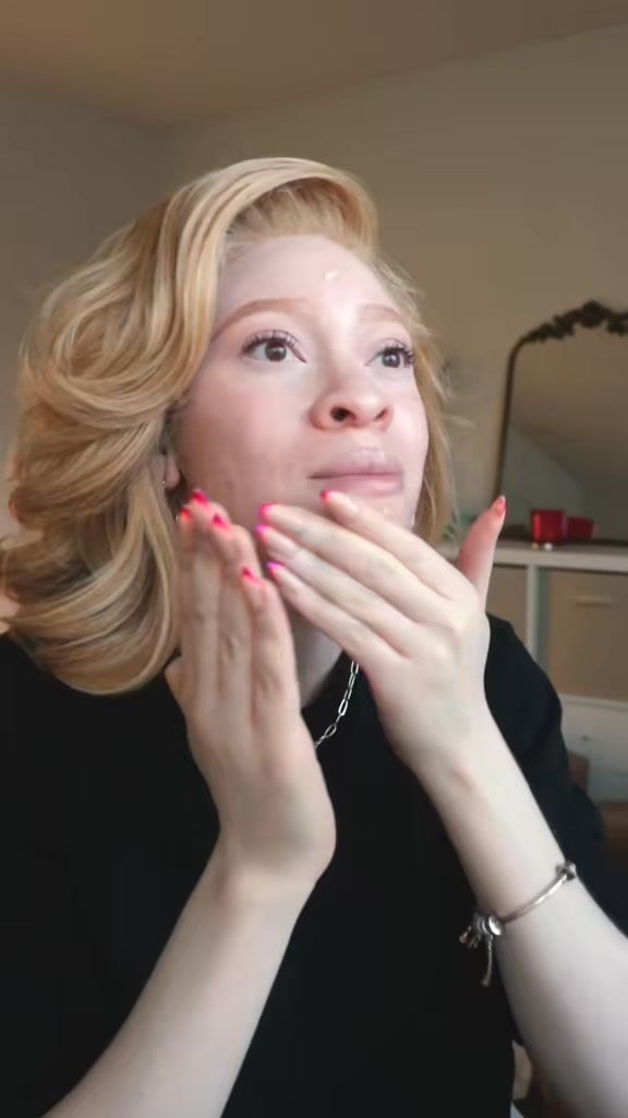 Iyana LeShea - The difference between Albinism and Albino:... | Facebook